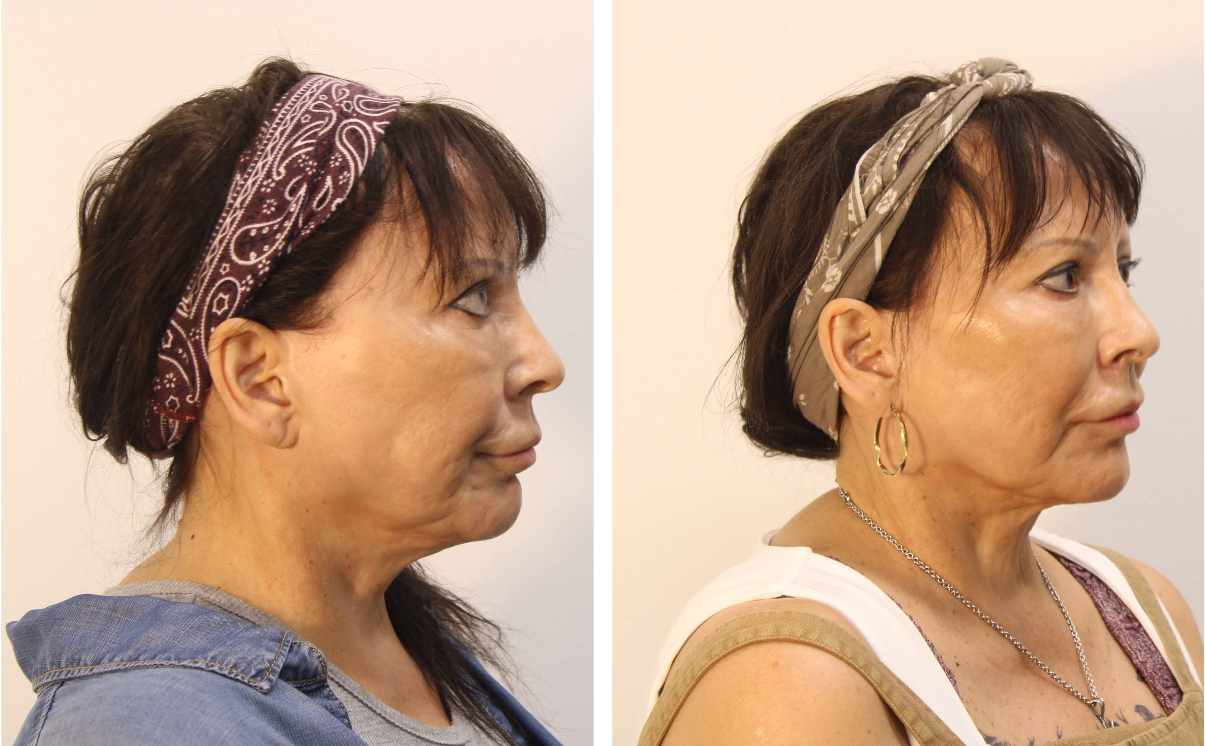 South Dakota Mines Professor Creates Next-Generation Skincare Technology